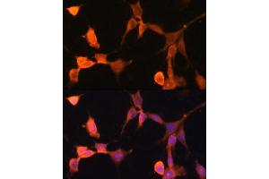 Immunofluorescence analysis of NIH-3T3 cells using CACYBP antibody  at dilution of 1:100. (CACYBP Antikörper  (AA 1-228))