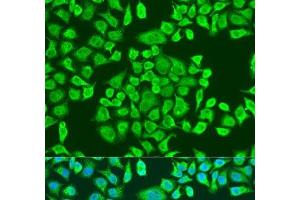 Immunofluorescence analysis of U2OS cells using IGF2BP3 Polyclonal Antibody at dilution of 1:100. (IGF2BP3 Antikörper)