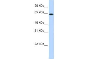 Western Blotting (WB) image for anti-RING Finger Protein 6 (RNF6) antibody (ABIN2461523) (RNF6 Antikörper)