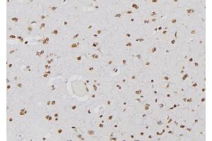 Immunohistochemistry (IHC) image for anti-Proteasome Subunit Alpha Type 3 (PSMA3) (Internal Region) antibody (ABIN6266152)