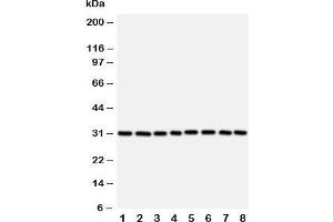 Western blot testing of VDAC1 antibody and Lane 1:  rat skeletal muscle;  2: (r) heart;  3: (r) liver; and human samples 4: HeLa;  5: A431;  6: A549;  7: SMMC-7721;  8: HT1080 cell lysate. (VDAC1 Antikörper  (Middle Region))