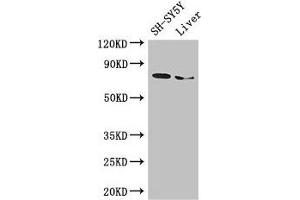 Western Blot Positive WB detected in: SH-SY5Y whole cell lysate, Mouse liver tissue All lanes: CHAT antibody at 3 μg/mL Secondary Goat polyclonal to rabbit IgG at 1/50000 dilution Predicted band size: 83, 75, 71 kDa Observed band size: 75 kDa (Choline Acetyltransferase Antikörper  (AA 354-592))
