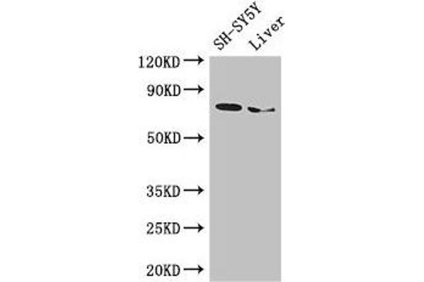 Choline Acetyltransferase Antikörper  (AA 354-592)