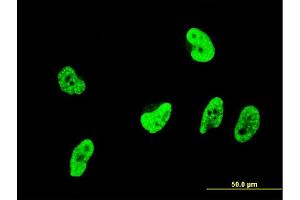 Immunofluorescence of monoclonal antibody to OXSR1 on HeLa cell. (OXSR1 Antikörper  (AA 351-450))