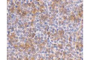 Immunohistochemical staining of human spleen using AP30069PU-N APOBEC3G antibody at 1 μg/ml. (APOBEC3G Antikörper  (N-Term))