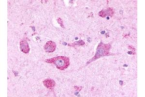 Immunohistochemical staining of Brain (Neurons) using anti- LPHN3 antibody ABIN122280 (LPHN3 Antikörper  (Cytoplasmic Domain))