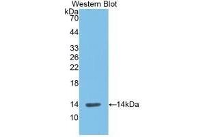 Detection of Recombinant REN, Rat using Monoclonal Antibody to Renin (REN) (Renin Antikörper  (AA 275-389))