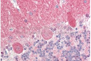 Immunohistochemistry (IHC) image for anti-Protein Phosphatase 3, Catalytic Subunit, alpha Isoform (PPP3CA) (Middle Region) antibody (ABIN2784524)
