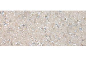 Immunohistochemistry of paraffin-embedded Human brain tissue using VILL Polyclonal Antibody at dilution of 1:65(x200)