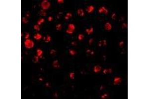 Immunofluorescence of IRAK2 in HeLa cells with AP30441PU-N IRAK antibody at 10 μg/ml. (IRAK2 Antikörper  (C-Term))