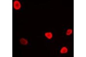 Immunofluorescent analysis of RFC4 staining in U2OS cells.