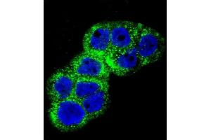 Immunofluorescence (IF) image for anti-Insulin-Like Growth Factor 1 Receptor (IGF1R) (AA 51-77), (N-Term) antibody (ABIN652374)