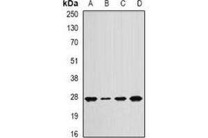 Western blot analysis of APC10 expression in Jurkat (A), mouse lung (B), mouse spleen (C), rat heart (D) whole cell lysates. (ANAPC10 Antikörper)