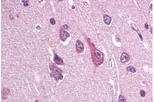 Human Brain, Cortex (formalin-fixed, paraffin-embedded) stained with SCN2B antibody ABIN337345 at 10-20 ug/ml followed by biotinylated goat anti-rabbit IgG secondary antibody ABIN481713, alkaline phosphatase-streptavidin and chromogen. (SCN2B Antikörper  (N-Term))