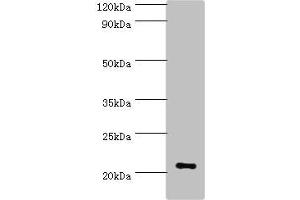 Western blot All lanes: ARF3 antibody at 6 μg/mL + Mouse brain tissue Secondary Goat polyclonal to rabbit IgG at 1/10000 dilution Predicted band size: 21, 17 kDa Observed band size: 21 kDa (ARF3 Antikörper  (AA 1-181))