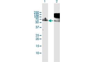 Western Blot analysis of RBM5 expression in transfected 293T cell line by RBM5 MaxPab polyclonal antibody. (RBM5 Antikörper  (AA 1-546))