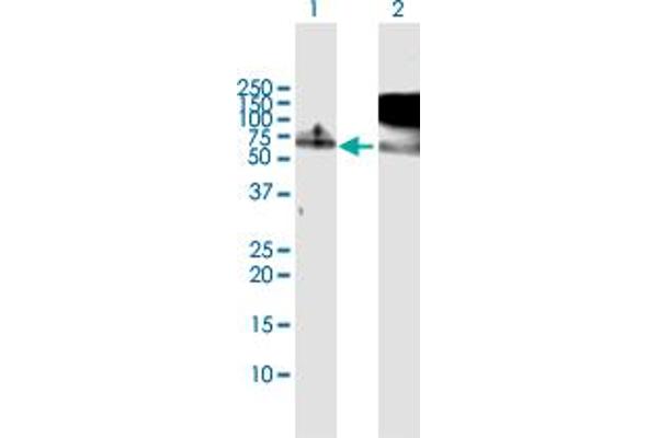 RBM5 Antikörper  (AA 1-546)