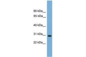 Image no. 1 for anti-Carbonic Anhydrase VB, Mitochondrial (CA5B) (AA 71-120) antibody (ABIN6744963) (CA5B Antikörper  (AA 71-120))