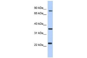 C17ORF82 antibody used at 1 ug/ml to detect target protein. (C17orf82 Antikörper  (N-Term))