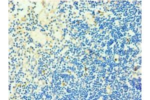 Immunohistochemistry of paraffin-embedded human thymus tissue using ABIN7173325 at dilution of 1:100 (TCOF1 Antikörper  (AA 1189-1488))