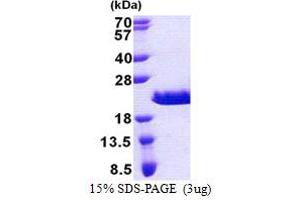 RPA Interacting Protein (RPAIN) (AA 1-106) protein (His tag)