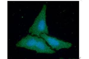 ICC/IF analysis of CKB in HeLa cells line, stained with DAPI (Blue) for nucleus staining and monoclonal anti-human CKB antibody (1:100) with goat anti-mouse IgG-Alexa fluor 488 conjugate (Green). (CKB Antikörper  (AA 1-381))