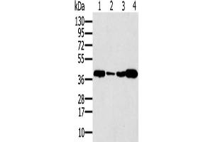 Gel: 12 % SDS-PAGE, Lysate: 40 μg, Lane 1-4: Human testis tissue, Human seminoma tissue, Jurkat cells, human liver cancer tissue, Primary antibody: ABIN7192710(SYCP3 Antibody) at dilution 1/200, Secondary antibody: Goat anti rabbit IgG at 1/8000 dilution, Exposure time: 40 seconds (SYCP3 Antikörper)
