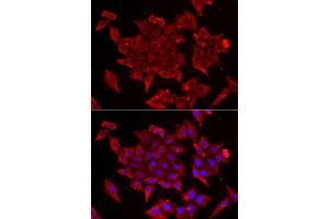 Immunofluorescence analysis of U2OS cells using TIMM17A antibody. (TIMM17A Antikörper)