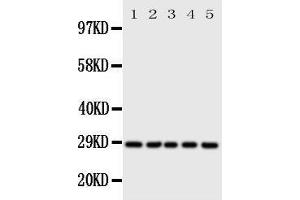 Western Blotting (WB) image for anti-Stratifin (SFN) (AA 140-156), (Middle Region) antibody (ABIN3044182)