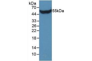 Detection of Recombinant STC1, Human using Monoclonal Antibody to Stanniocalcin 1 (STC1) (Stanniocalcin 1 Antikörper  (AA 28-247))