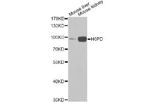 Western blot analysis of extracts of various cell lines, using H6PD Antibody. (Glucose-6-Phosphate Dehydrogenase Antikörper)