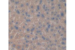 IHC-P analysis of liver tissue, with DAB staining. (CES1 Antikörper  (AA 31-286))