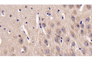 Detection of CSNK1d in Human Cerebrum Tissue using Monoclonal Antibody to Casein Kinase 1 Delta (CSNK1d) (Casein Kinase 1 delta Antikörper  (AA 1-409))