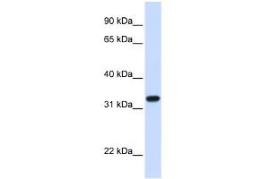 WB Suggested Anti-TBCB Antibody Titration: 0. (TBCB Antikörper  (C-Term))