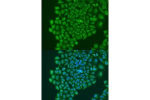 Western blot analysis of extracts of HepG2 cells, using YB-1/YB-1/YBX1 antibody (ABIN7271411) at 1:1000 dilution. (YBX1 Antikörper  (AA 100-200))