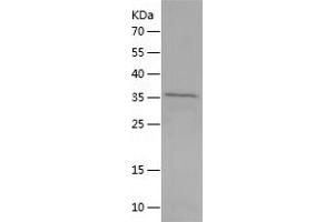 Western Blotting (WB) image for Musashi Homolog 2 (MSI2) (AA 1-328) protein (His tag) (ABIN7288309) (MSI2 Protein (AA 1-328) (His tag))