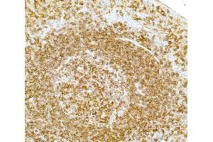 Immunohistochemistry (IHC) image for anti-MHC Class II HLA-DP/DQ/DR (HLA-DP/DQ/DR) antibody (ABIN7449429) (MHC Class II HLA-DP/DQ/DR Antikörper)