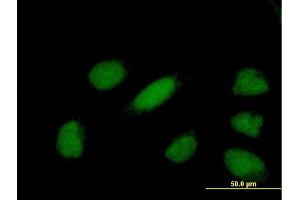 Immunofluorescence of purified MaxPab antibody to YEATS4 on HeLa cell. (GAS41 Antikörper  (AA 1-227))