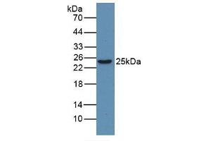 Figure. (HMGB1 Antikörper  (AA 1-215))
