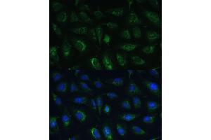 Immunofluorescence analysis of U-2 OS cells using R Polyclonal Antibody (ABIN7269849) at dilution of 1:100 (40x lens). (GRF2 Antikörper  (AA 844-1095))