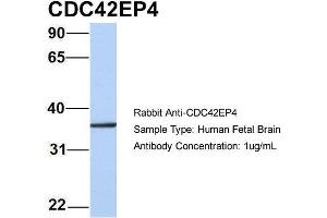 Host: Rabbit Target Name: CDC42EP4 Sample Type: Human Fetal Brain Antibody Dilution: 1. (CDC42EP4 Antikörper  (N-Term))