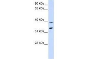 Image no. 1 for anti-Solute Carrier Family 25, Member 34 (SLC25A34) (C-Term) antibody (ABIN6740861) (SLC25A34 Antikörper  (C-Term))