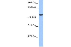 WB Suggested Anti-REXO4 Antibody Titration:  0. (REXO4 Antikörper  (Middle Region))