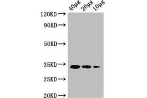 Western Blot Positive WB detected in: Rosseta bacteria lysate at 40 μg, 20 μg, 10 μg All lanes: ldcA antibody at 1 μg/mL Secondary Goat polyclonal to rabbit IgG at 1/50000 dilution predicted band size: 34 kDa observed band size: 34 kDa (LDCA (AA 1-304) Antikörper (Biotin))