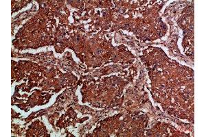 Immunohistochemistry (IHC) image for anti-Fms-Related Tyrosine Kinase 4 (FLT4) (AA 720-760) antibody (ABIN7189527)