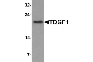 Western Blotting (WB) image for anti-Teratocarcinoma-Derived Growth Factor 1 (TDGF1) (N-Term) antibody (ABIN1077401) (TDGF1 Antikörper  (N-Term))