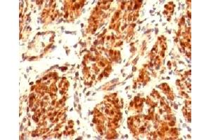 IHC testing of FFPE human uterus and Calponin antibody (clone CLPN5-1).
