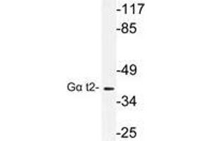 Western blot (WB) analysis of Gα t2 antibody in extracts from COLO cells. (GNAT2 Antikörper)