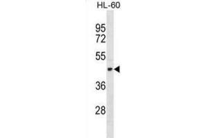 Western Blotting (WB) image for anti-Tektin 1 (TEKT1) antibody (ABIN2998950) (TEKT1 Antikörper)