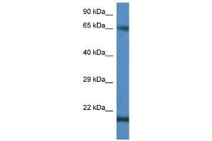 Western Blotting (WB) image for anti-Cancer/testis Antigen 1B (CTAG1B) (C-Term) antibody (ABIN926593)